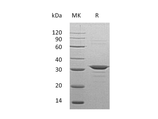 Recombinant Human CLIC4 (N-6His)
