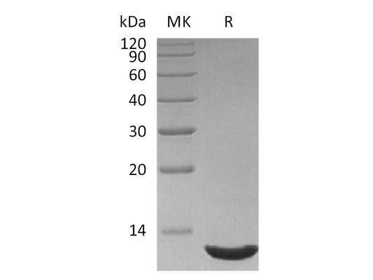 Recombinant Human CXCL12(75AA)