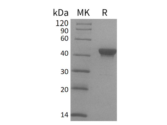 Recombinant Human CTH