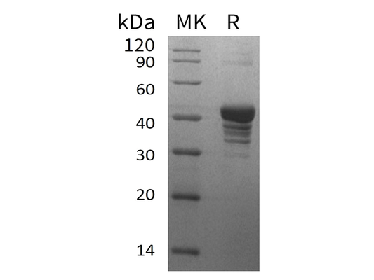 Recombinant Human UQCRH (N-GST)