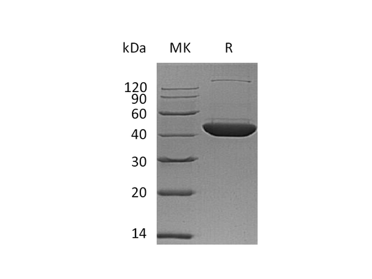 Recombinant Human DHS (C-6His)