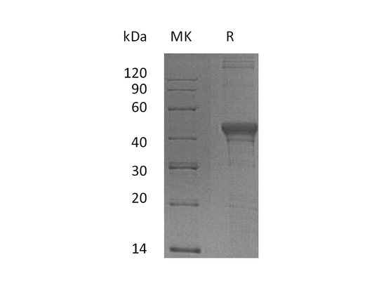 Recombinant Human DFF45 (N-6His)