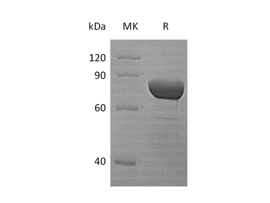 Recombinant Human DPP3 (N-6His)