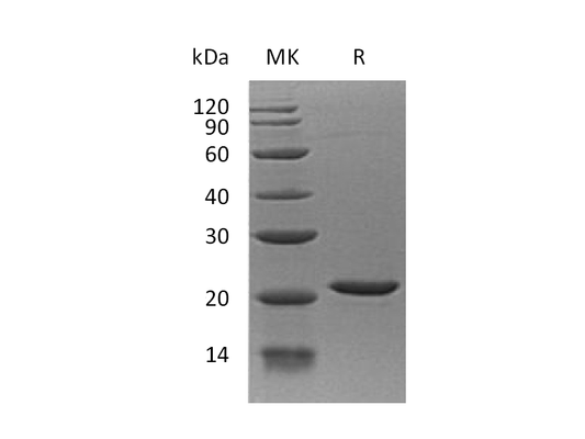Recombinant Human EIF1AX (N-6His)