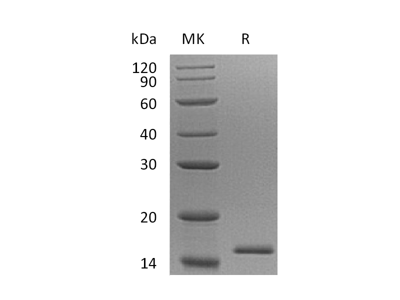 Recombinant Human EIF1B (N-6His)