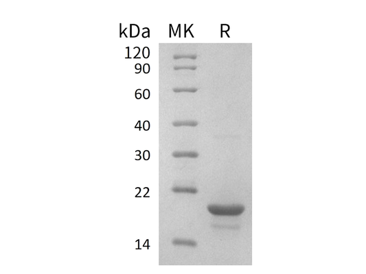 Recombinant Human EIF4EBP1 (N-6His)