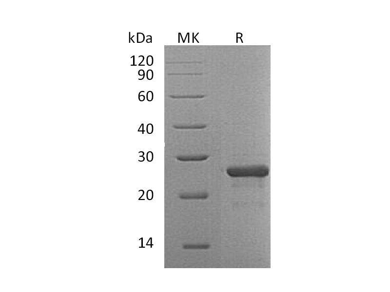 Recombinant Human FGF-19 (N-6His)