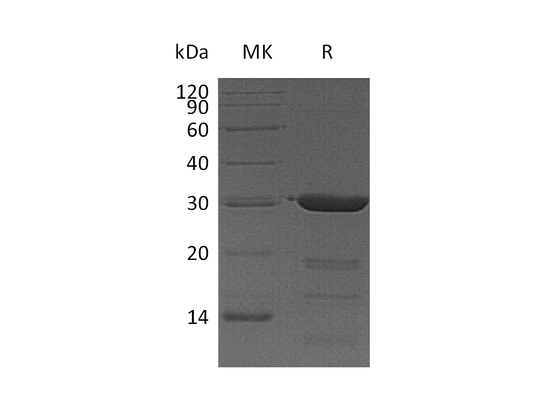 Recombinant Human FKBP3 (N-6His)