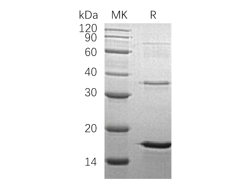 Recombinant Human LSM4 (N-6His)