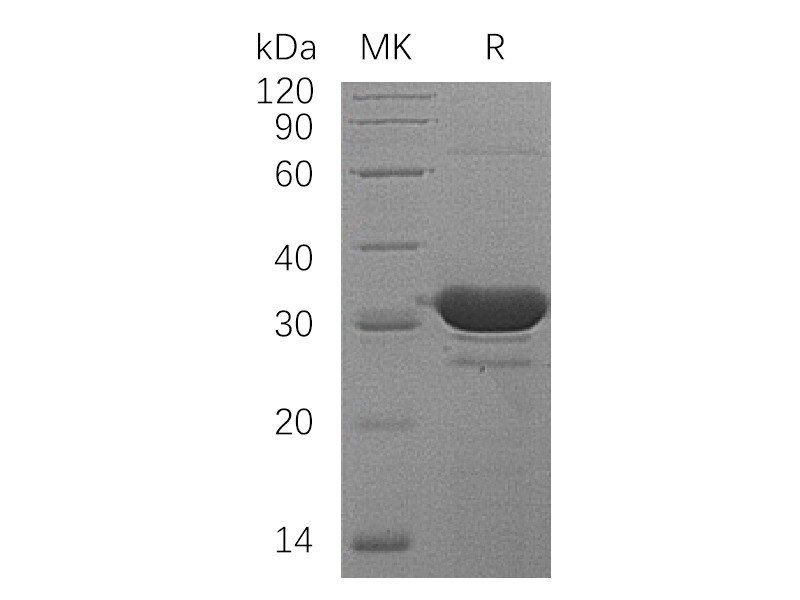 Recombinant Human HDHD2 (N-6His)