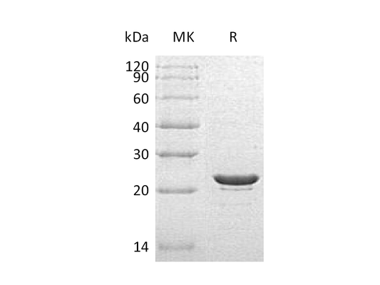Recombinant Human HSPB8 (C-6His)