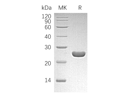 Recombinant Human PGDS