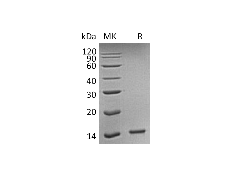 Recombinant Human HDGF (C-6His)