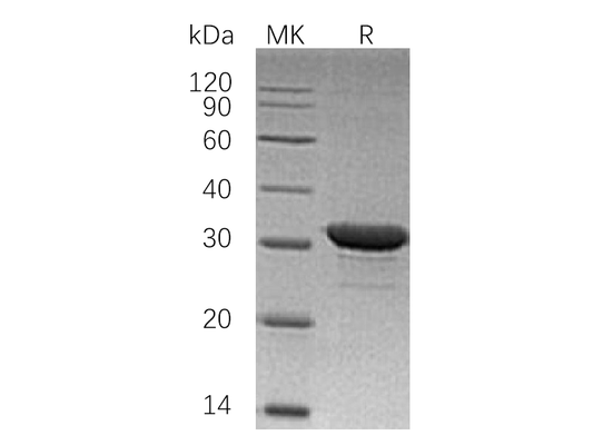 Recombinant Human IMPase1 (N-6His)