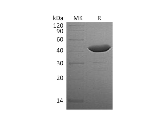 Recombinant Human IDO (N-6His)