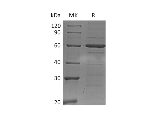 Recombinant Human IRF5 (C-6His)