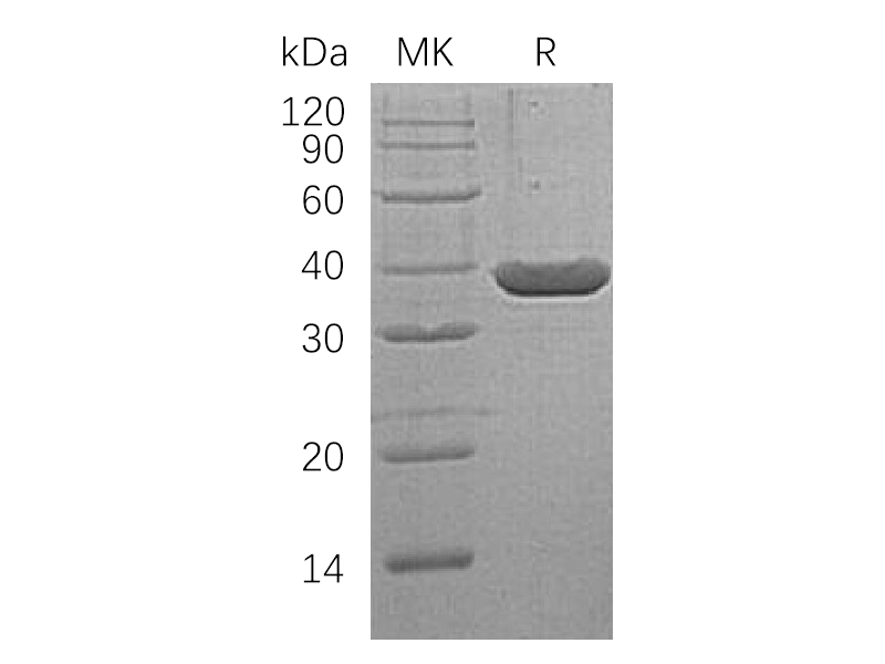 Recombinant Human LDH-A (N-6His)