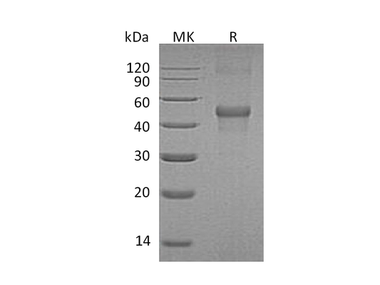 Recombinant Human LMCD1 (N, C-6His)