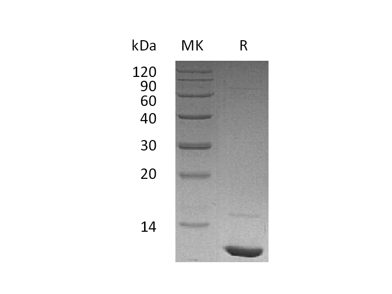 Recombinant Human IGF-I