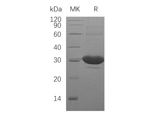 Recombinant Human DCXR (N-6His)
