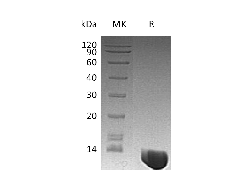 Recombinant Human MIF(N-6His)