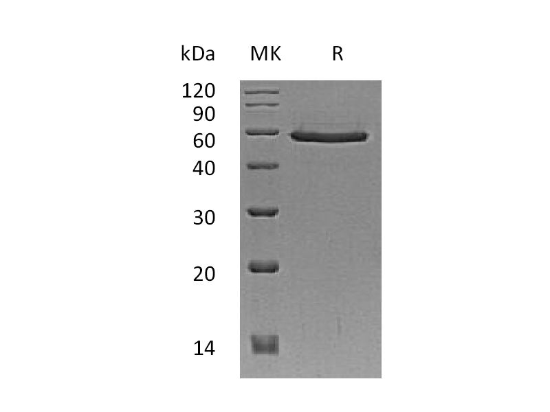 Recombinant Human SMAD3 (N-6His-Flag)
