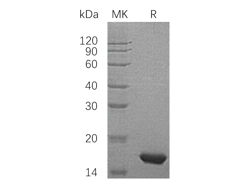 Recombinant Human PMP2 (N-6His)