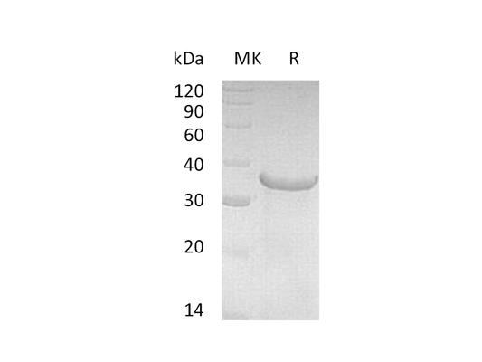 Recombinant Human NRG1Beta (245AA)