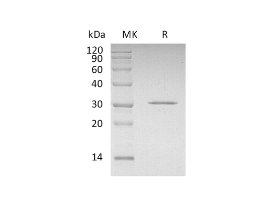 Recombinant Human CDKN1B (N-6His)