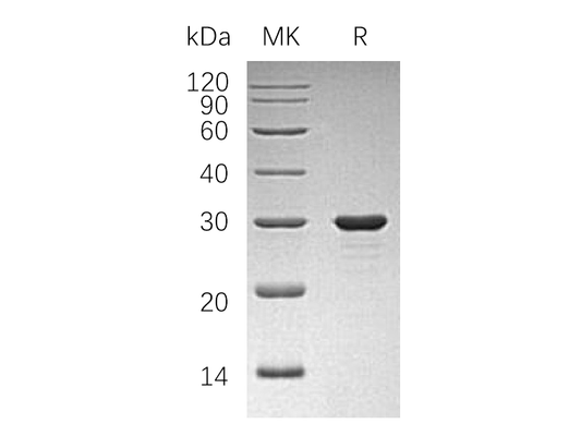 Recombinant Human PAP (N-6His)