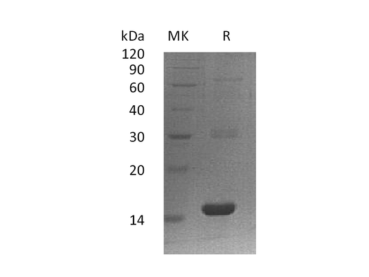 Recombinant Human PLA2G16 (N-6His)
