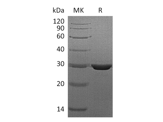 Recombinant Human PMM2 (C-6His)