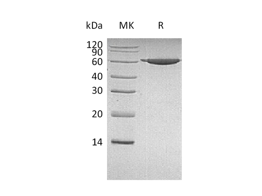 Recombinant Human PKM2 (N-6His)