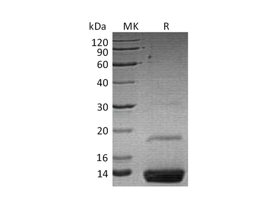 Recombinant Human Resistin  (C-6His)