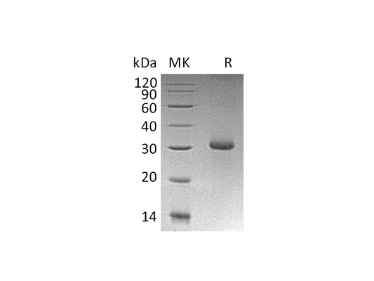 Recombinant Human RGMA (N-6His)