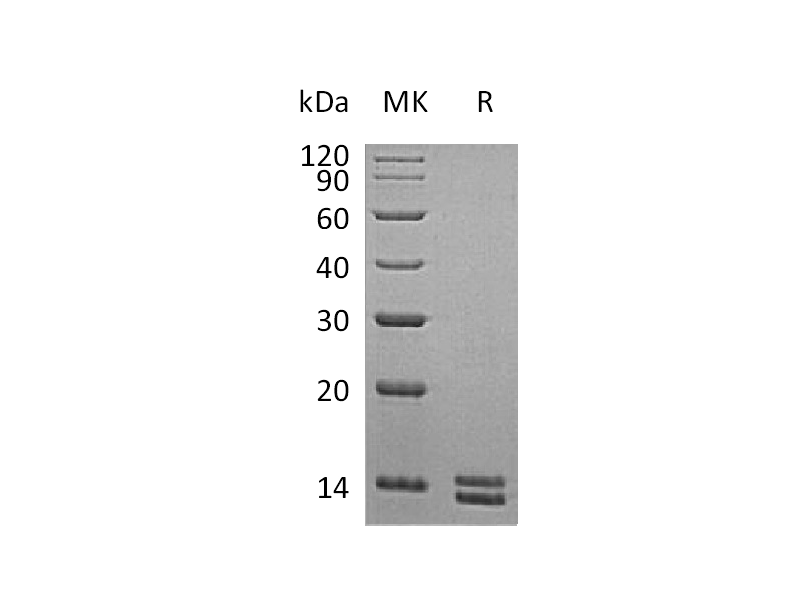 Recombinant Human S100A8/A9 Heterodimer (C-6His)