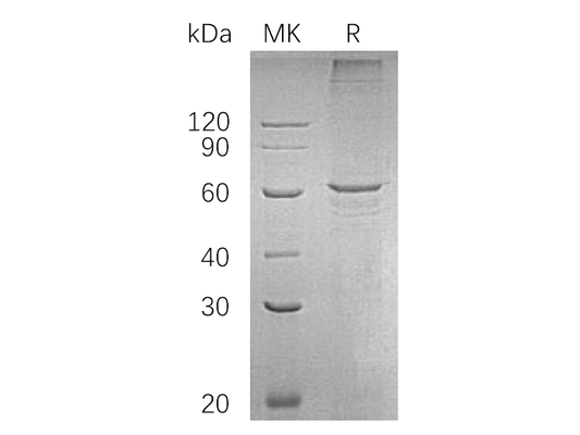 Recombinant Human SMAD4 (C-6His)