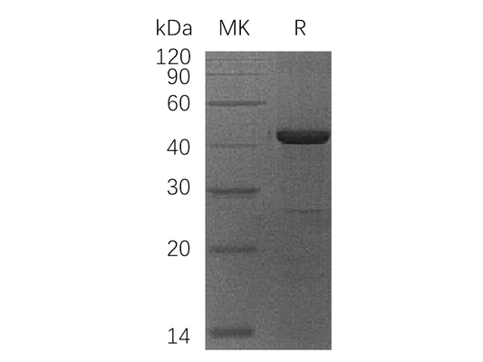 Recombinant Human OBFc1 (N-6His)