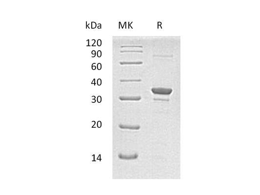 Recombinant Human SULT1A2 (N-6His)