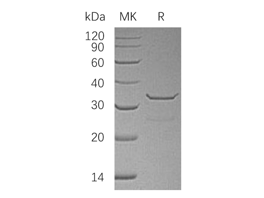 Recombinant Human SULT1B1 (N-6His)