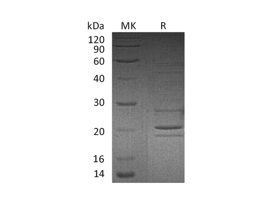Recombinant Human STX8