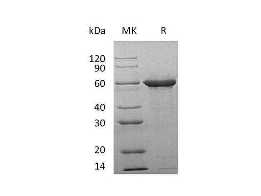 Recombinant Human Tau-F
