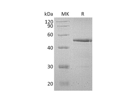 Recombinant Human Testin (C-6His)