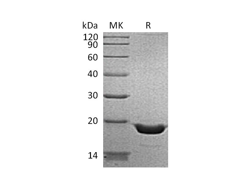 Recombinant Human TNF alpha (N-6His)