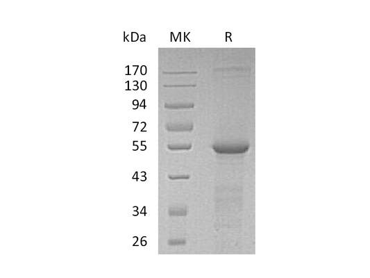 Recombinant Human TUBB4A (N-6His)