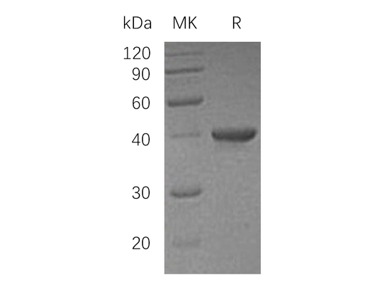 Recombinant Human UBE2I (N-GST)