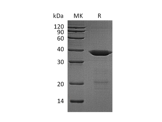 Recombinant Human UBE2K (N-6His, SUMO tag)