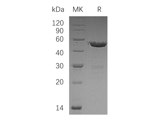 Recombinant Human UBE2S (N-GST)