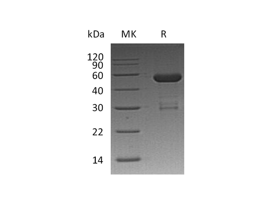 Recombinant Human OTUB2 (N-GST)