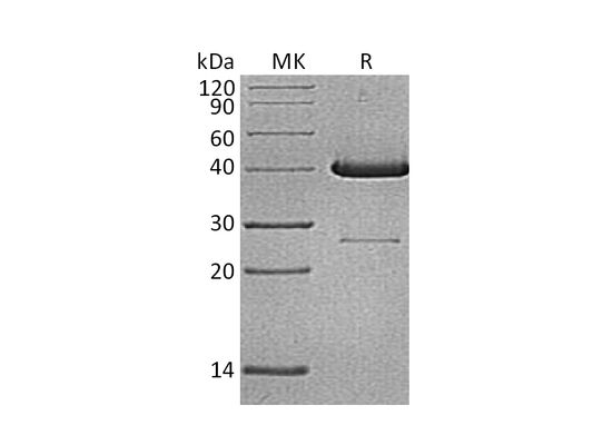 Recombinant Human UBE2D1 (N-GST)